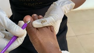 Omg See The Amount Of Dirt Pedicure Tutorial