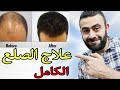علاج اقوي حالات الصلع الوراثي عند الرجال الصلع التام Hair Loss Treatment For Men 