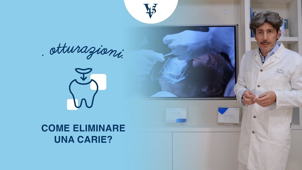 Otturazioni: come eliminare una carie?