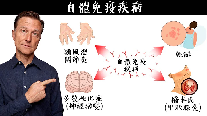 自體免疫疾病7原因和自然療法,柏格醫生 Dr Berg - 天天要聞