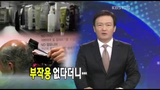 염색약(염모제) 부작용없다더니....