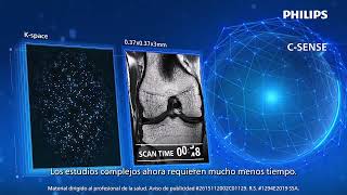Dé un paso adelante con SmartSpeed Precise
