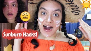 Sunburns are the worst and i get them all time so today i'll share my
tips with you guys! stay safe! thanks for watching! //maria
-----------------------...