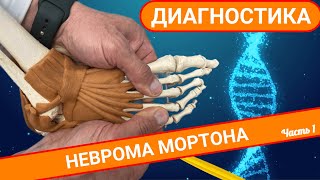 НЕВРОМА МОРТОНА: что это и как диагностировать? (Часть 1)