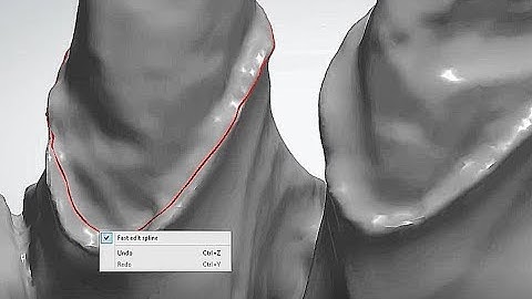 How to make a  smooth margin line in 3shape when have trouble with it