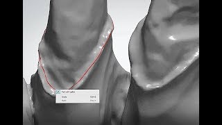 How to make a  smooth margin line in 3shape when have trouble with it