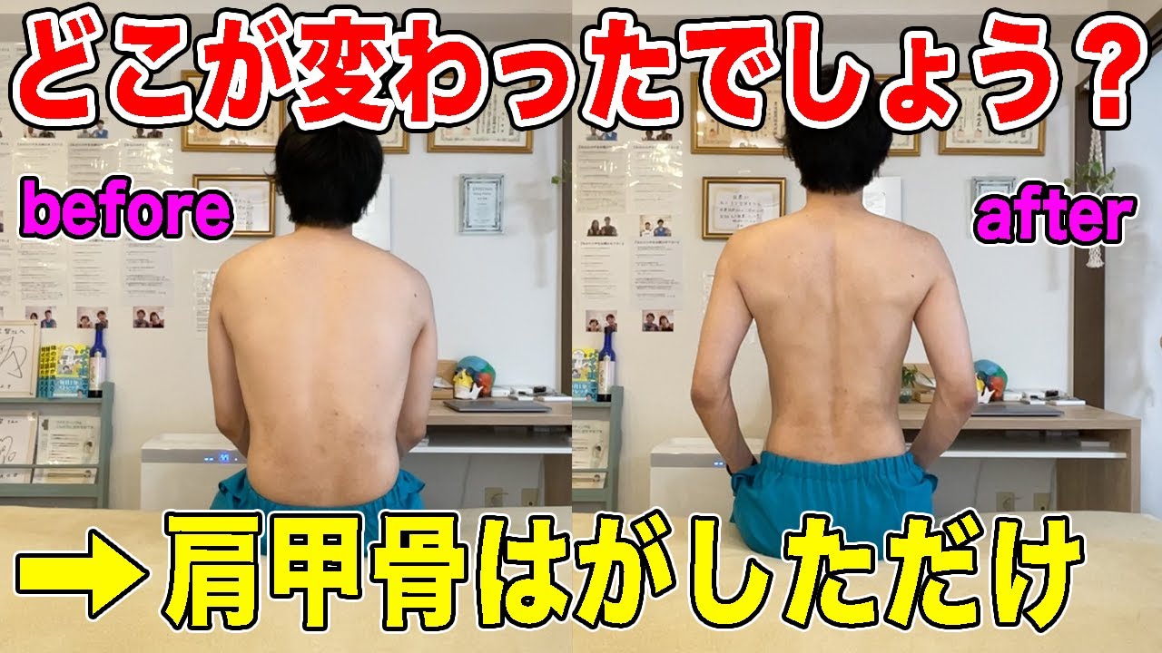 【肩甲骨はがし】姿勢が悪くなるのは肩甲骨のせい！姿勢改善で腰痛や首こり肩こり頭痛が消え、代謝上がって痩せ体質にもなる！