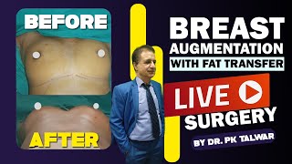 [Live] Breast Augmentation by Fat Injection, Increase Breast Size With Fat Transfer | Dr PK Talwar