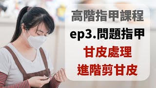 甘皮處理 甘皮修剪｜問題指甲處理｜高階指甲線上課 第3季第3集