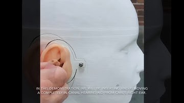 Inserting and Removing a Completely-In-the-Canal (CIC) Hearing Aid Using CARL