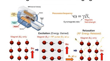 Class 5 Prediction of brain age using MRI data