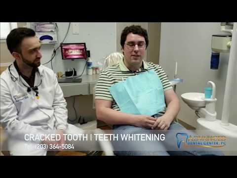 Chipped or Broken Tooth Treatment and Repair