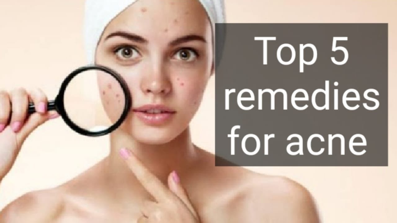 5 Best remedies for acne - YouTube