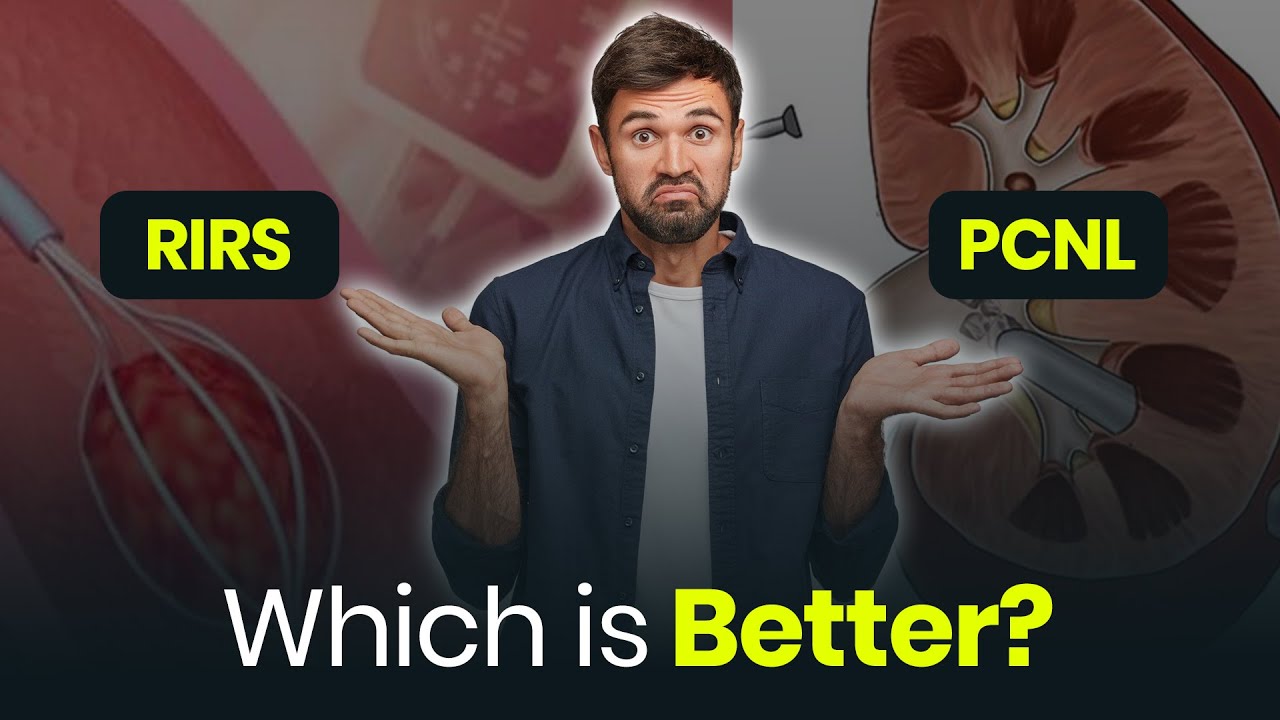 RIRS vs PCNL – Which Is Better for Kidney Stones? | Confused between RIRS & PCNL? Doctor explains
