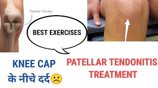 Patellar Tendonitis Exercises | Knee pain while jumping | Pain below knee cap | Jumpers knee Hindi