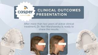 Two Years of CASPER Class II Correction: Clinical Outcomes with Dr. Neil Warshawsky