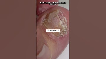 3 Surprising Signs Your Egg Quality Needs Help #fertilitytips