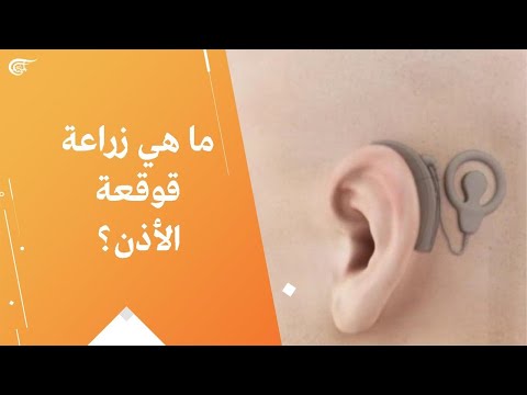 فيديو: هل تعيد غرسات القوقعة السمع إلى طبيعتها؟