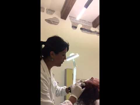 Mesoterapia cuoio capelluto - Trattamento Contro la caduta dei capelli - Dott.ssa Jasmine Fuhr
