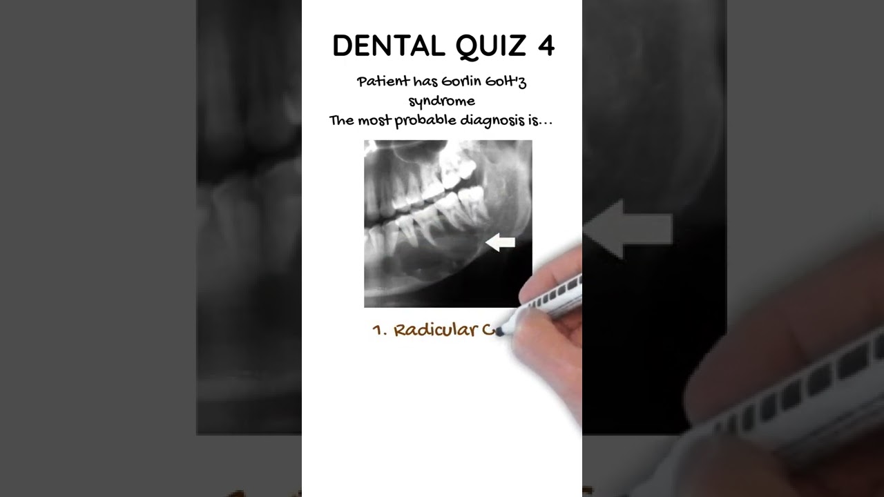 Can you diagnosis this cystic lesion #4 ? Clue is patient has Gorlin Syndrome.