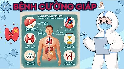 Bệnh cường giáp nguyên nhân triệu chứng và cách điều trị hiệu quả