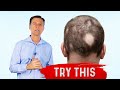 Onions, The Best Food for Alopecia Treatment &ndash; Dr.Berg