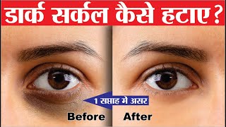 dark circles kaise hataye | dark circles home remedy | how to remove dark circles