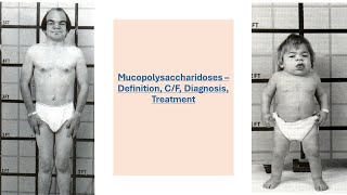 Mucopolysaccharidosis Biochemistry || Mucopolysaccharidosis