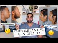 Chin Implant vs. Genioplasty
