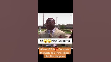 😲😲‼️#shortvideo #shortsfeed #trending #viral #2024 #shortsviral #trendingshorts #viralshort