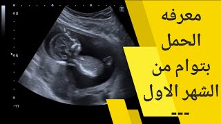 معرفة الحمل بتوأم من الشهر الأول | وما هي علامات الحمل بتوأم من الشهر الأول