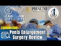 Penis Enlargement + Mons Pubis Liposuction | More Girth &amp; Length Increase | Surgery Review