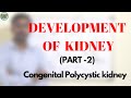 DEVELOPMENT OF KIDNEY PART 2 #CONGENITALPOLYCYSTICKIDNEY