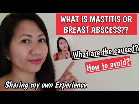 Video: Ano ang fibrous breast disease at kung paano magamot