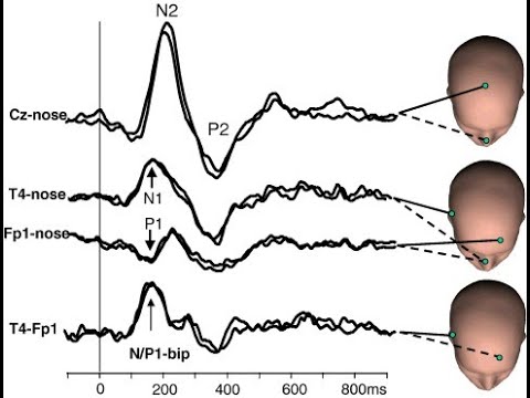 Denoising a Signal