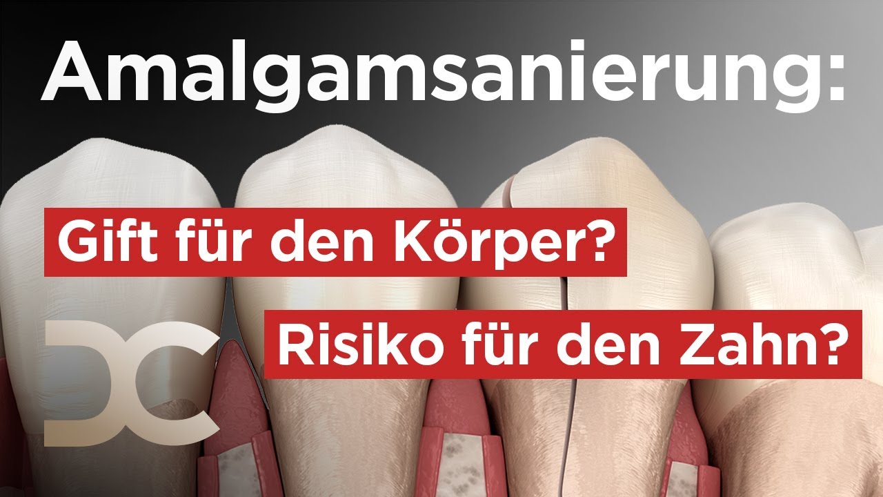 Amalgamfüllung austauschen oder nicht? Interview mit Dr. Kass | Dorow Clinic - YouTube