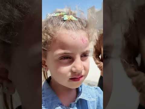 العربية ترصد تفشي اللشمانيا في حلب... مناشدات طبية لتدخل عاجل لاحتواء الأزمة الصحية قبل تفاقمها