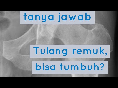 Video: Tulang Mentah: Apakah Mereka Benar-Benar Retak?