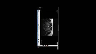 Musculoskeletal System Radiology NHS DKT FRCR Viva Part 1(Dr. Imran Khan) screenshot 4