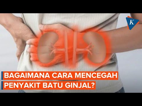 Lima Cara Cegah Batu Ginjal