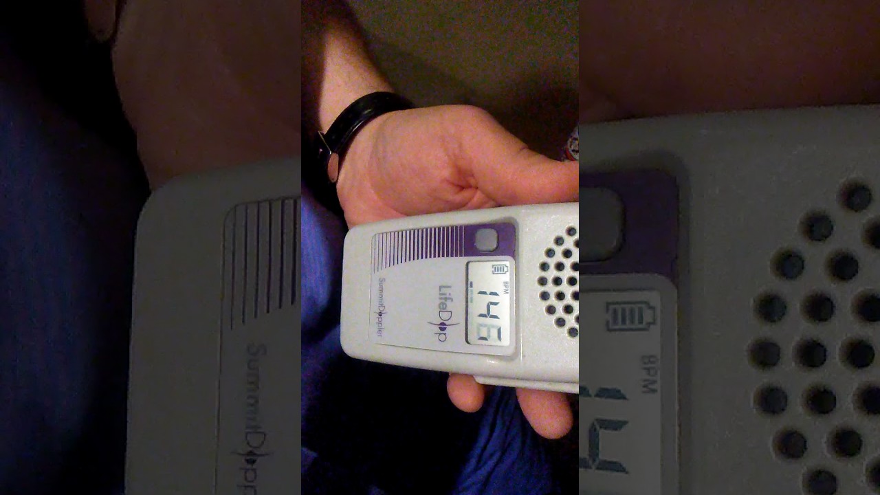 my baby boys heart beat YouTube