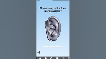 🔸️3D scanning technology in anaplastology 👂#prosthetics #3dprinting #3danimation