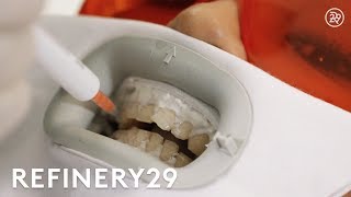 I Got Zoom Teeth Whitening For The First Time | Macro Beauty | Refinery29