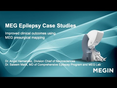 Magnetoencephalography Epilepsy Case Studies explained by Dr Angel Hernandez and Dr Saleem Malik