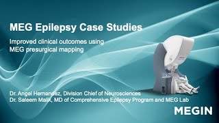 Magnetoencephalography Epilepsy Case Studies explained by Dr Angel Hernandez and Dr Saleem Malik
