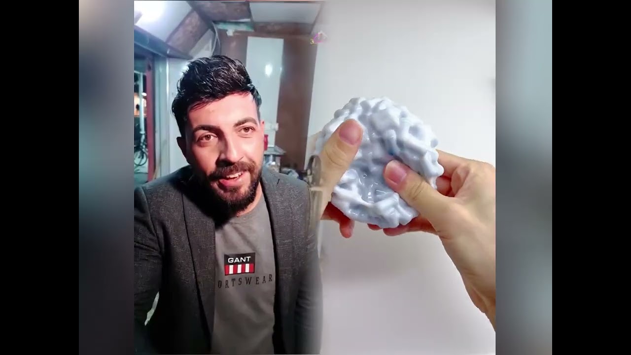 #الطفل الاعمى المعجزه #محضوره_من_الاكسبلور_والمشاهدات #علاوي_مارتن #اكسبلور 15_w