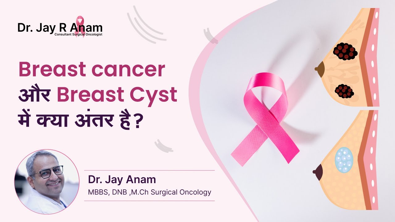 Skin cancer on breast ?  Or is it breast cancer - Dr Jay Anam