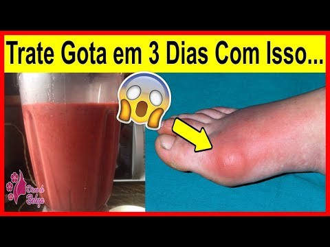 Ele Bebeu Este Suco Natural e Sua Gota Desapareceu em 3 Dias! Surpreendente!