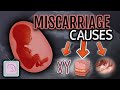 Dr. Morris' Ultimate Guide to Recurrent Miscarriage Testing