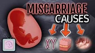Dr. Morris' Ultimate Guide to Recurrent Miscarriage Testing